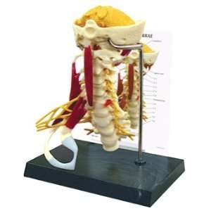 GPI Anatomical Deluxe Muscled Cervical Spine Model:  