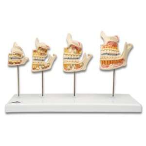  Dentition Development Model
