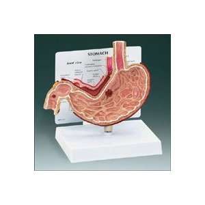 Stomach with Ulcers Model  Industrial & Scientific