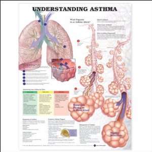 Understanding Asthma Anatomical Chart 20 X 26 Laminated 
