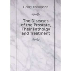  Diseases of the Prostate Henry Thompson Books